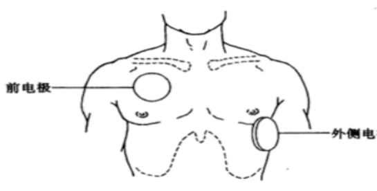 bb935e48f94d80b0859bfd8e728eb1b7